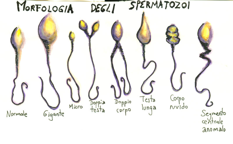 morphologie spermatozoides