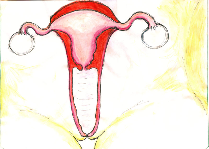 endometrio